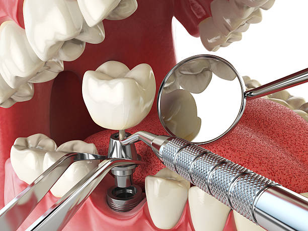 Best Tooth Infection Emergency Dentist  in Bell, CA